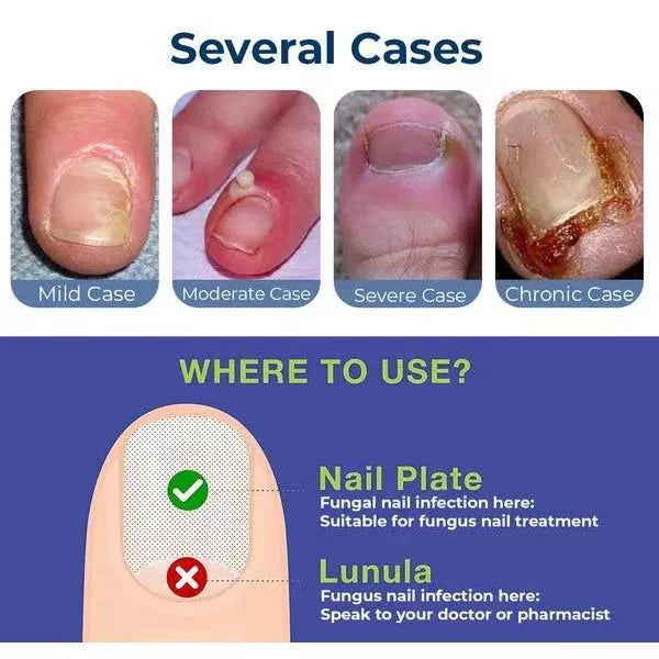 Nails Strong Growth And Repair Oli ( Pack Of 2)