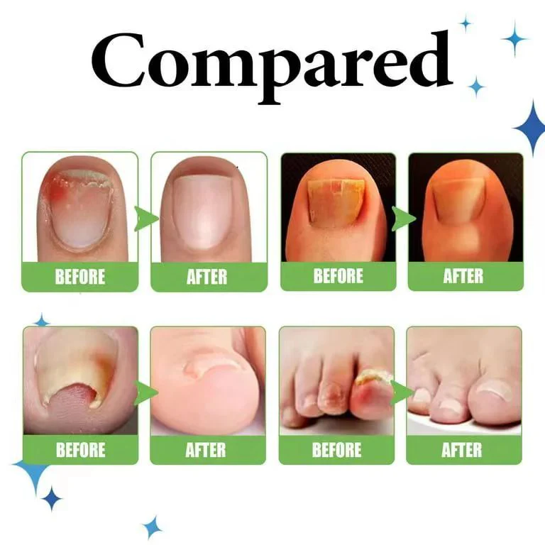 Nails Strong Growth And Repair Oli ( Pack Of 2)